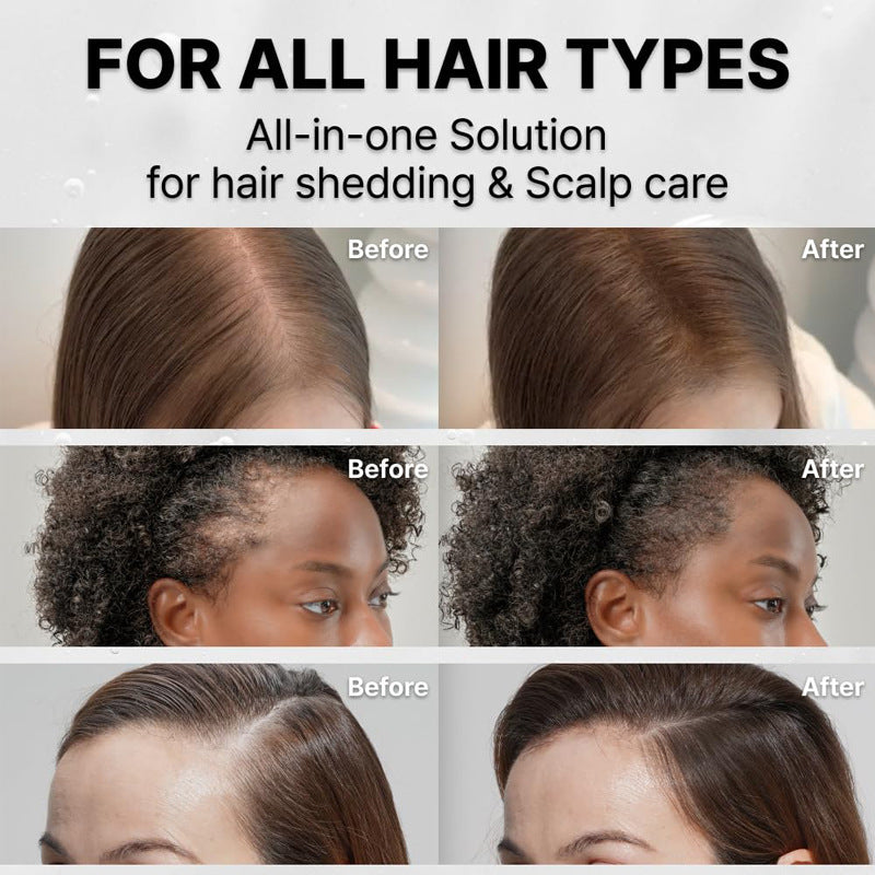 Hair Care Serum With Built-in Brush