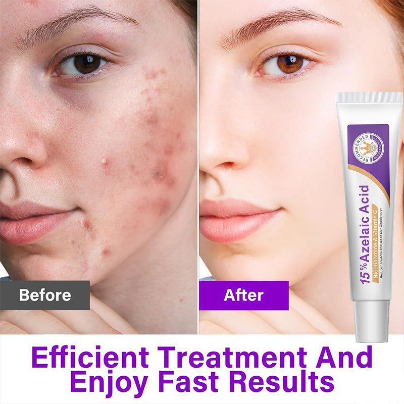 Azelaic Acid Serum 20g