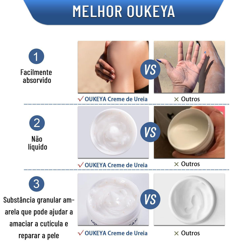 Urea Cream 150ml